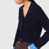Cardigan con dettagli rimovibili Cardigan con dettagli rimovibili